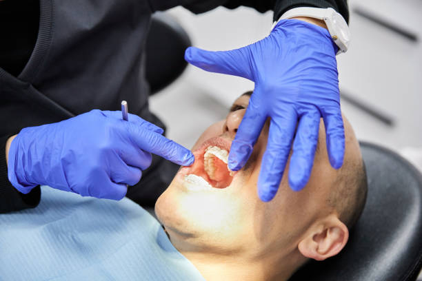 Best Urgent Care for Lost Fillings or Crowns in Rice Lake, WI
