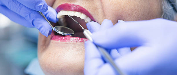 Best Emergency Dental Care for Broken or Chipped Teeth in Rice Lake, WI